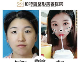 丽铂整形,专业塑美，匠心独运，打造美丽蜕变新篇章”