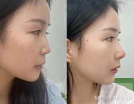 哪个整形比较好,探寻美丽守护者的卓越之地